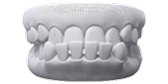 Underbite